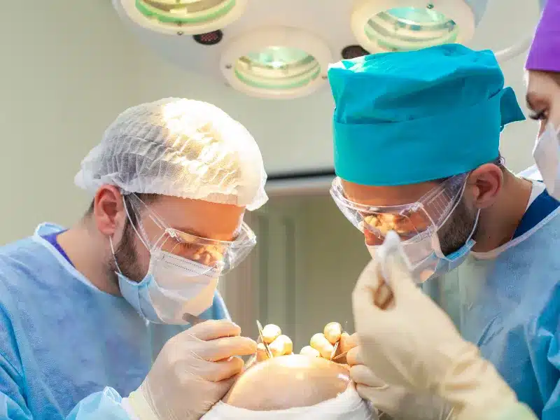 FUE hair transplant surgery procedure day